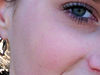 Cheek